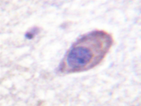兔抗KCNJ16(Ab-416) 多克隆抗体