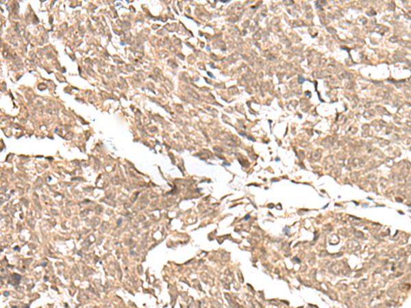 兔抗KDM2A多克隆抗体