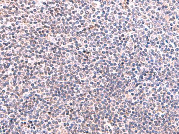 兔抗KIR3DL1多克隆抗体