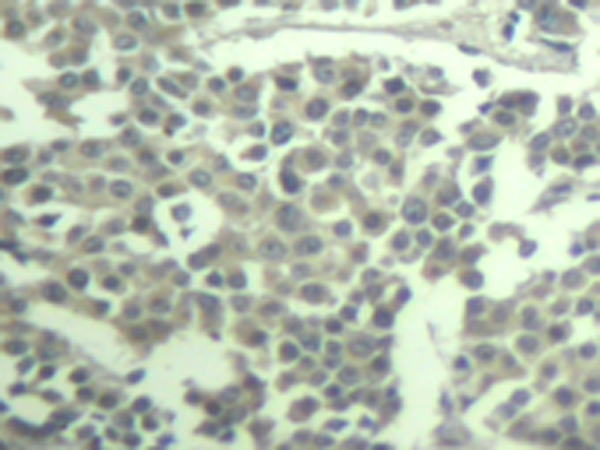 兔抗KIT (phospho-Tyr936)多克隆抗体