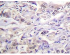 兔抗HNRNPD(Phospho-Ser83) 多克隆抗体