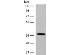 兔抗HOXA10多克隆抗体