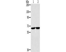 兔抗HSD17B4多克隆抗体