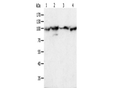 兔抗HSP90B1多克隆抗体