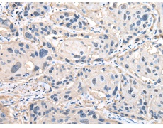 兔抗HSP90AB1多克隆抗体