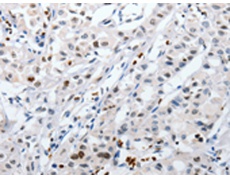 兔抗HSPA1A多克隆抗体