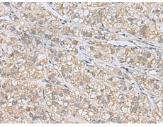 兔抗HSPB11多克隆抗体