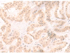 兔抗IL33多克隆抗体