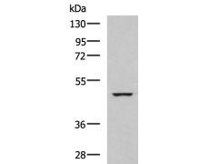 兔抗IP6K2多克隆抗体