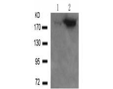 兔抗IRS1 (Phospho-Ser636) 多克隆抗体