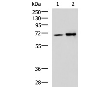 兔抗IGF2BP3多克隆抗体