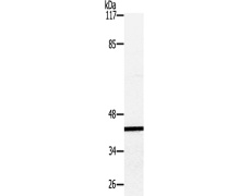 兔抗IKBKG(Ab-85) 多克隆抗体
