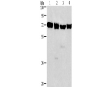兔抗IL2RB多克隆抗体