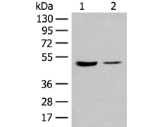 兔抗IL7R多克隆抗体