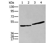 兔抗IL9R多克隆抗体