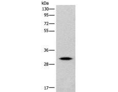 兔抗IMPA1多克隆抗体
