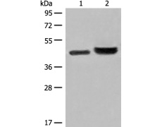兔抗INPP1多克隆抗体