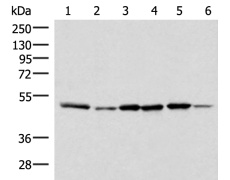 兔抗IP6K1多克隆抗体