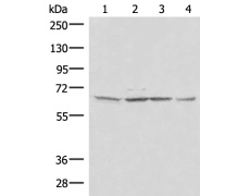兔抗IRF2BP2多克隆抗体