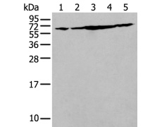 兔抗IRF5多克隆抗体