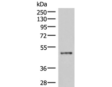 兔抗IRX5多克隆抗体