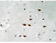 兔抗ITCH(Phospho-Tyr420) 多克隆抗体