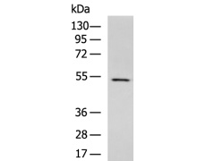 兔抗KATNAL1多克隆抗体