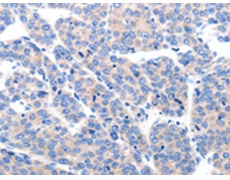 兔抗KCNH8多克隆抗体
