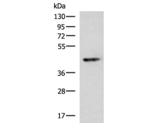 兔抗KCNK2多克隆抗体