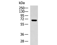 兔抗KCNN2多克隆抗体