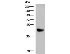 兔抗KIR2DL5A多克隆抗体