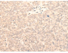 兔抗KLHDC2多克隆抗体