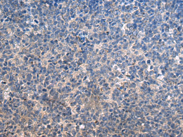 兔抗HSPA5多克隆抗体