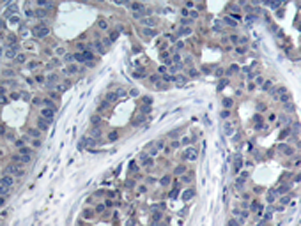 兔抗IRS1 (Phospho-Ser636) 多克隆抗体