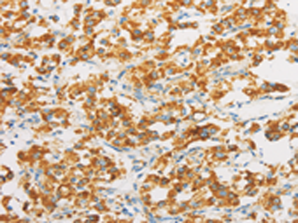 兔抗IDH3G多克隆抗体