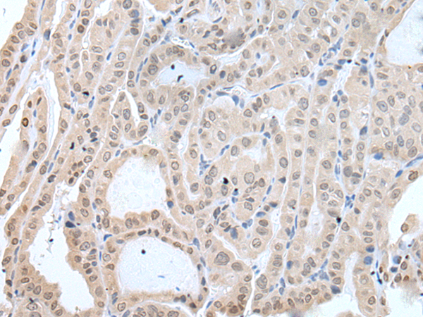 兔抗IFNB1多克隆抗体