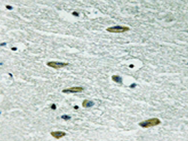 兔抗IGF1R(Ab-1346) 多克隆抗体
