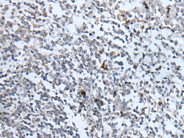 兔抗IL6R多克隆抗体