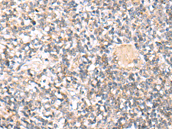 兔抗IL36A多克隆抗体