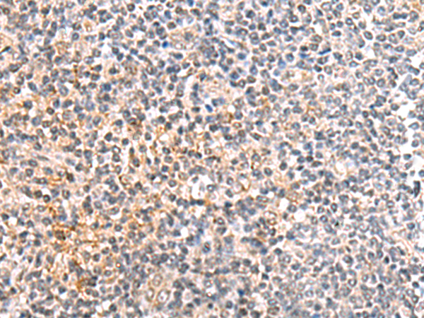 兔抗IL36B多克隆抗体