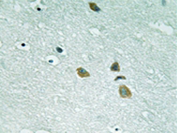 兔抗ILK(Ab-246) 多克隆抗体