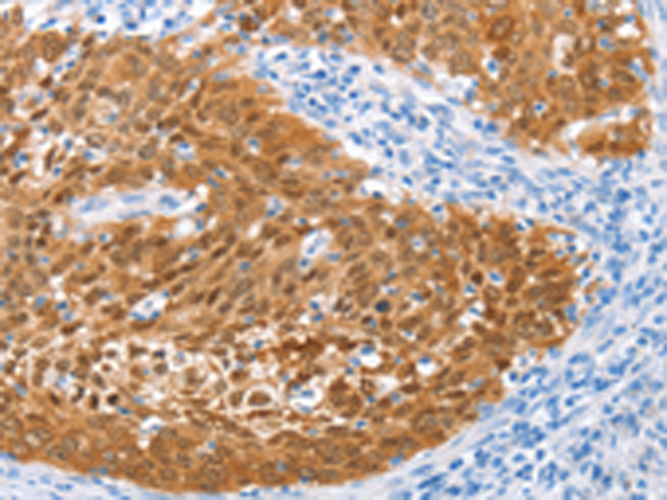 兔抗IRF6多克隆抗体