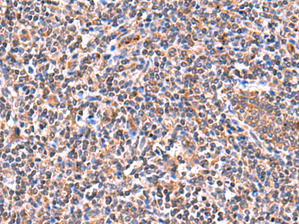 兔抗ISM1多克隆抗体