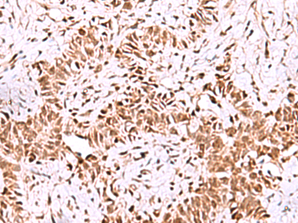 兔抗ISY1-RAB43多克隆抗体