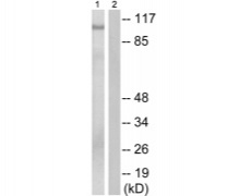 兔抗GAB2(Phospho-Ser159) 多克隆抗体