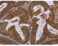 兔抗LCMT1多克隆抗体