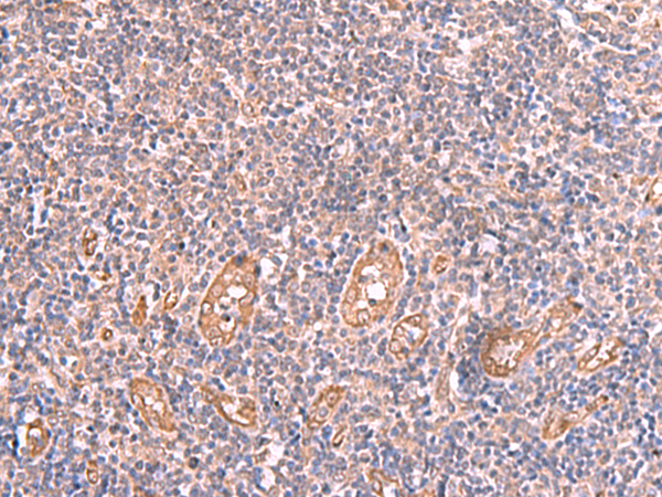 兔抗LMCD1多克隆抗体