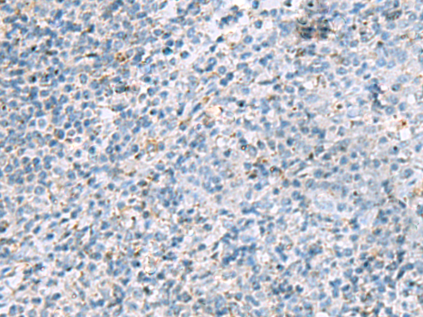 兔抗LRRC4多克隆抗体