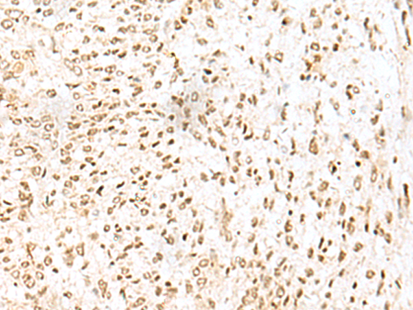 兔抗LYRM1多克隆抗体