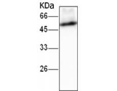 小鼠抗PSMD4单克隆抗体